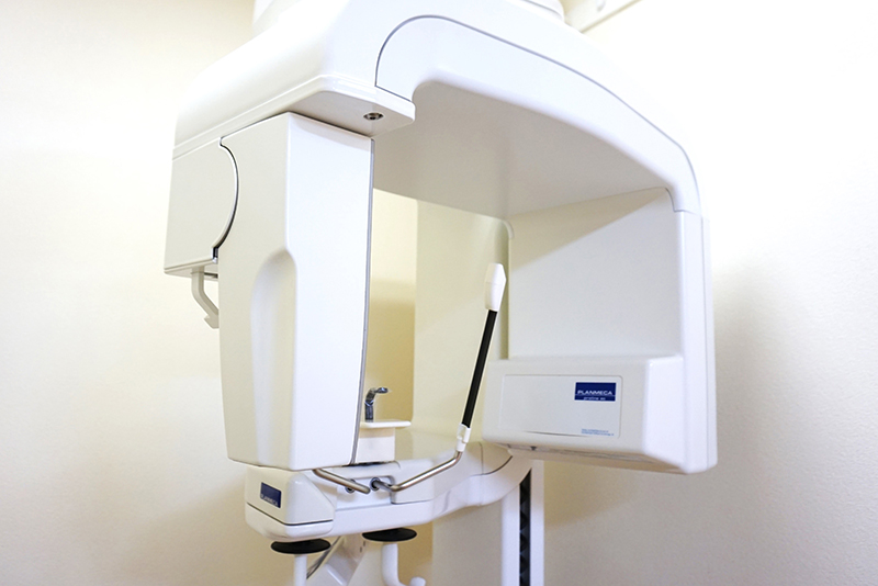 デジタルレントゲン