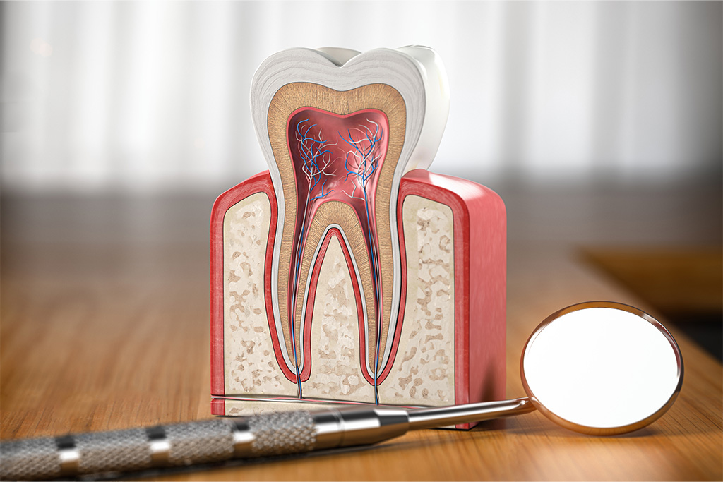 根管治療（歯内療法）