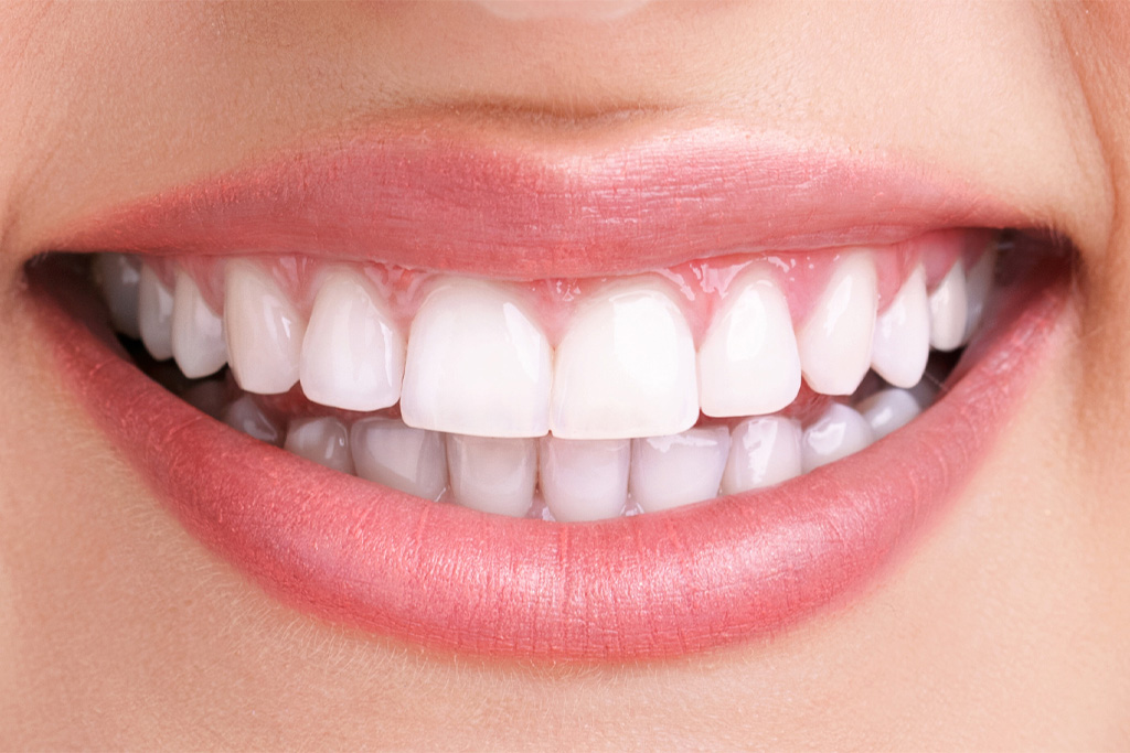 ホワイトニング